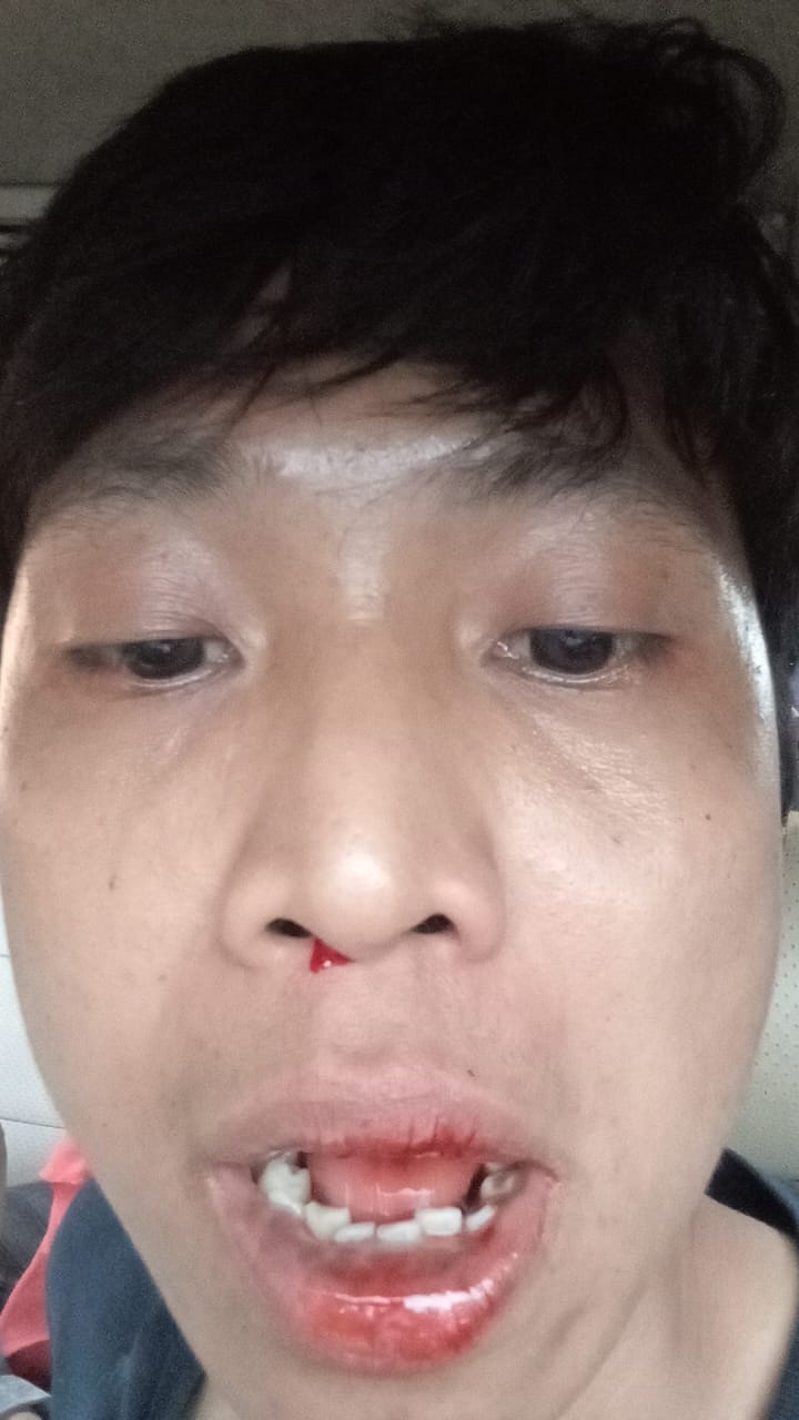 Wartawan Jadi Korban Pengeroyokan di Batanghari, Kasus Resmi Dilaporkan ke Polda Jambi